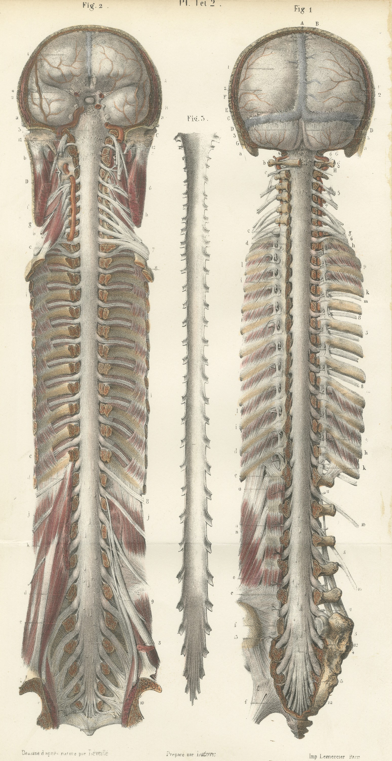 Brain and Spinal Cord in Situ, Hirschfeld Double Folding Plate, 1866