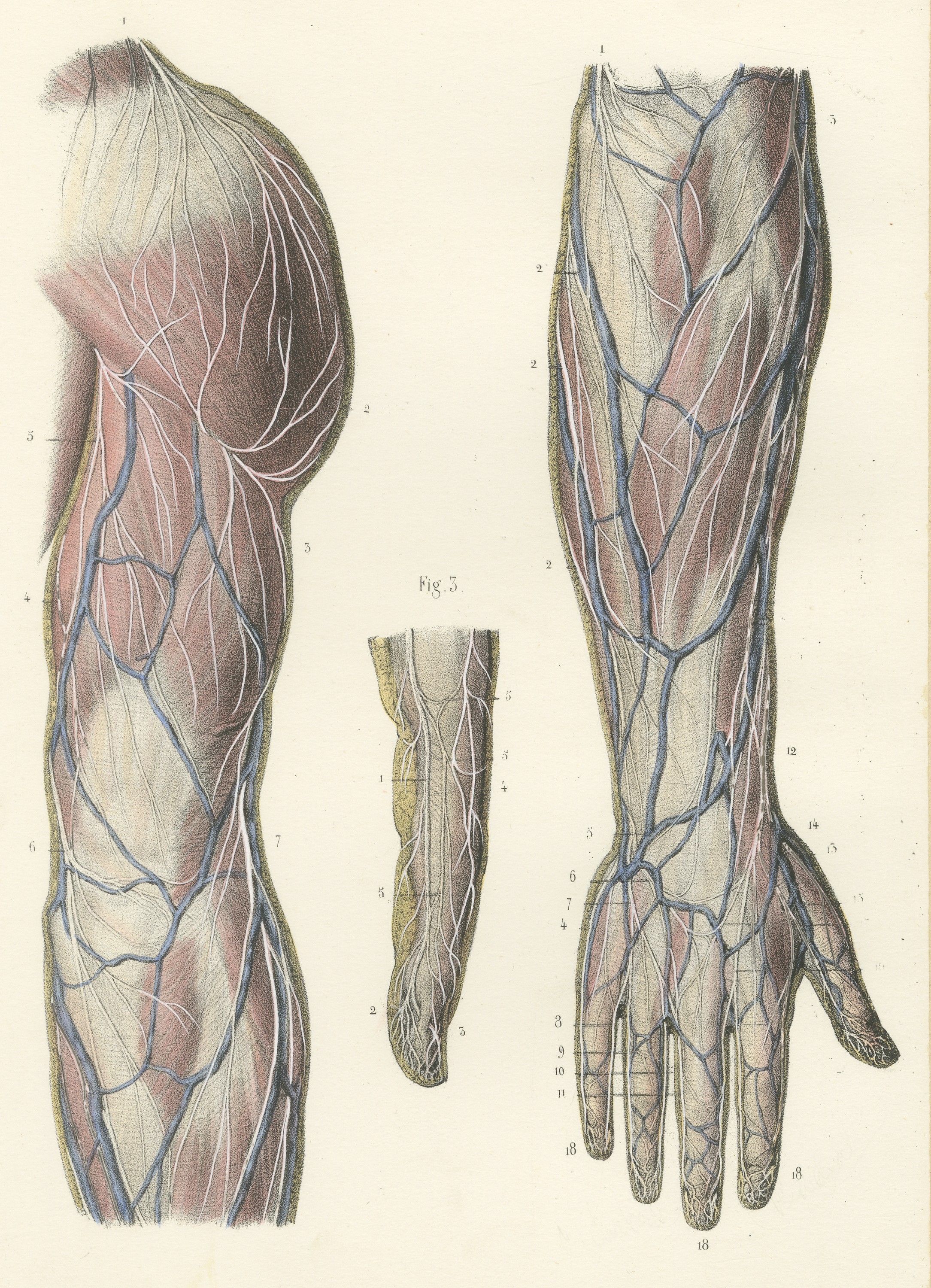 Nerves of the Back of the Arm and Hand, Antique Hirschfeld Anatomy Print, 1866