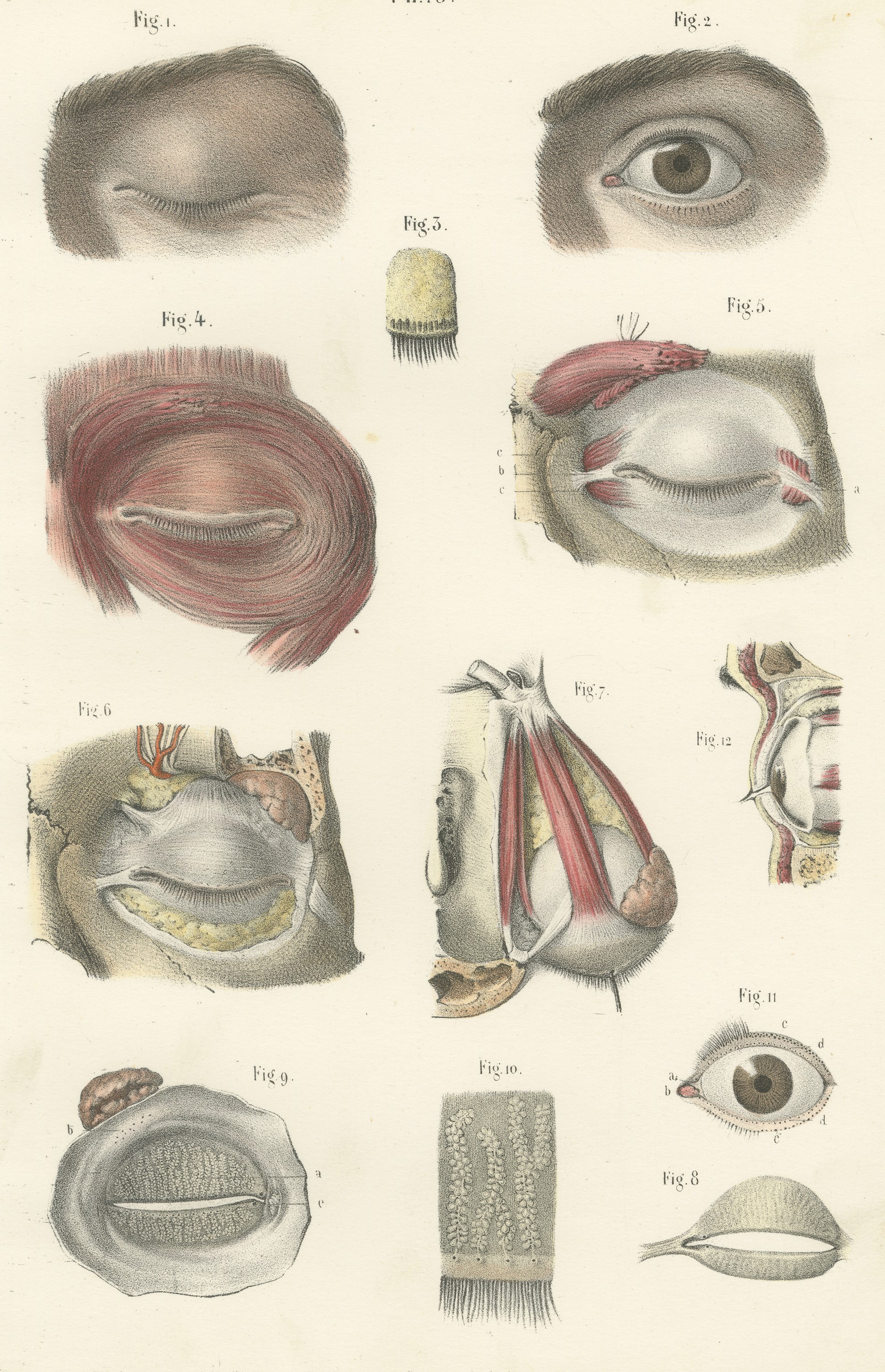 The Eyelids and Lacrimal Gland, Antique Hirschfeld Anatomy Print, 1866