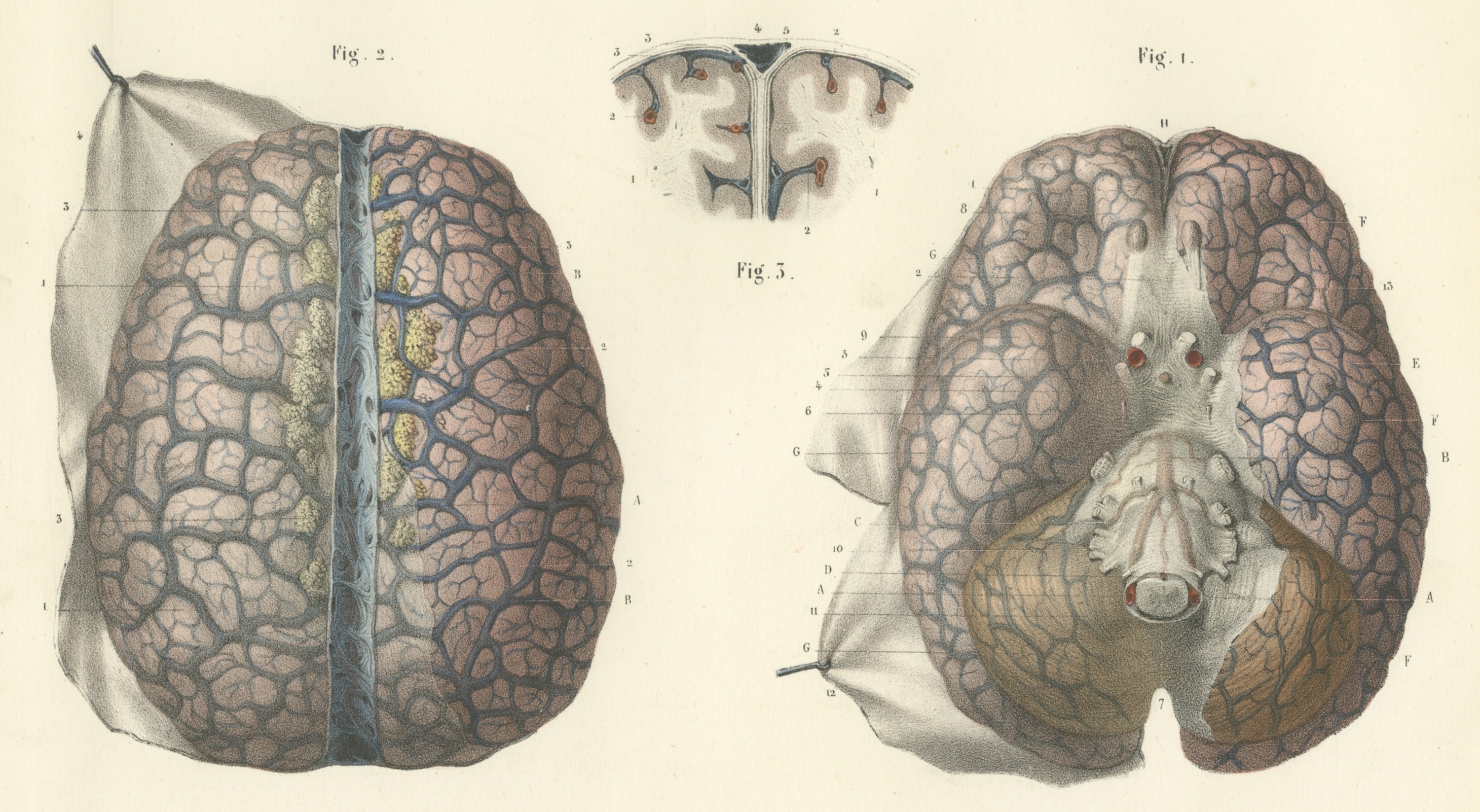 Veins of the Cerebral Hemispheres, Antique Hirschfeld Anatomy Print, 1866