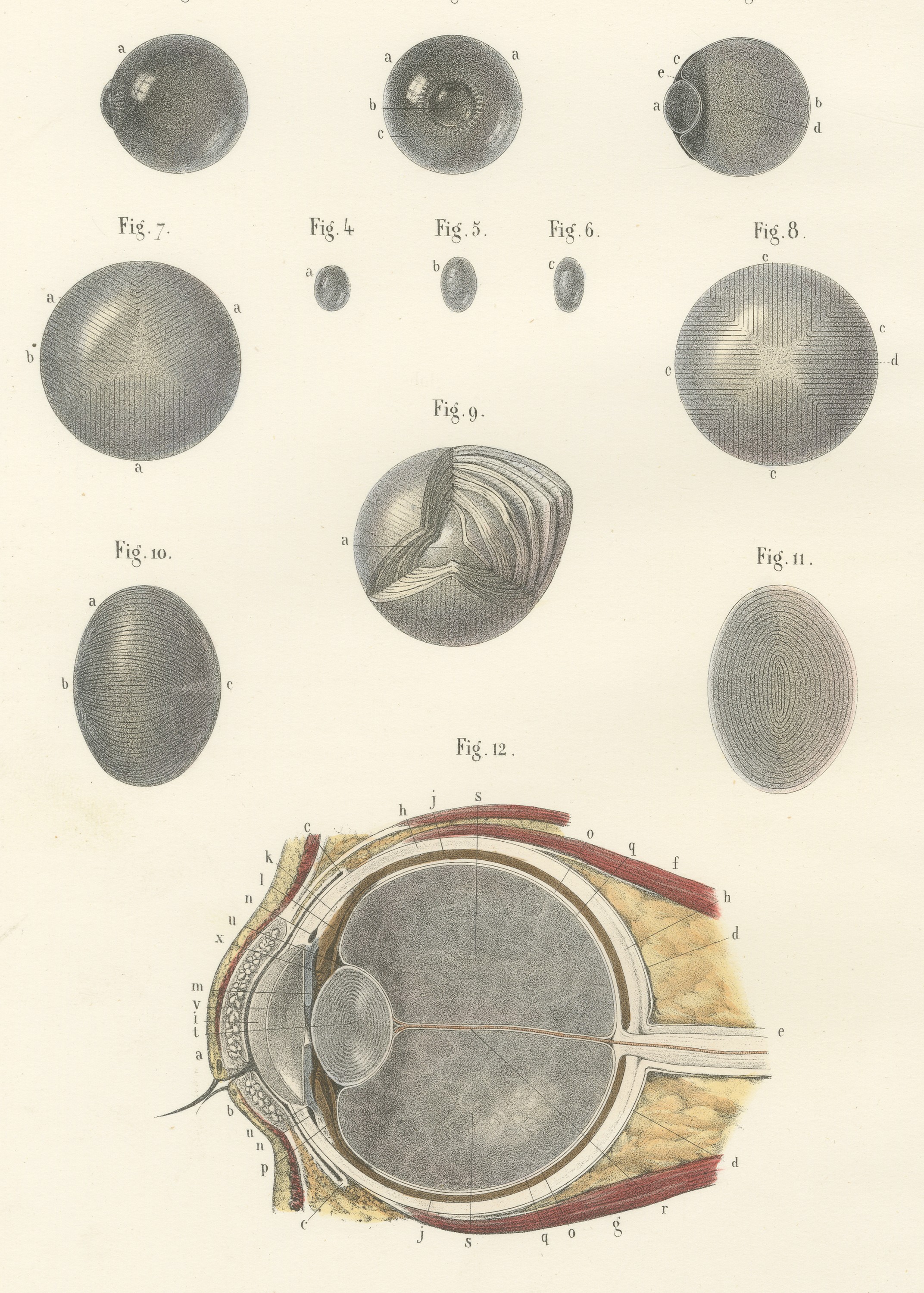 The Crystalline Lens, Antique Hirschfeld Anatomy Print, 1866