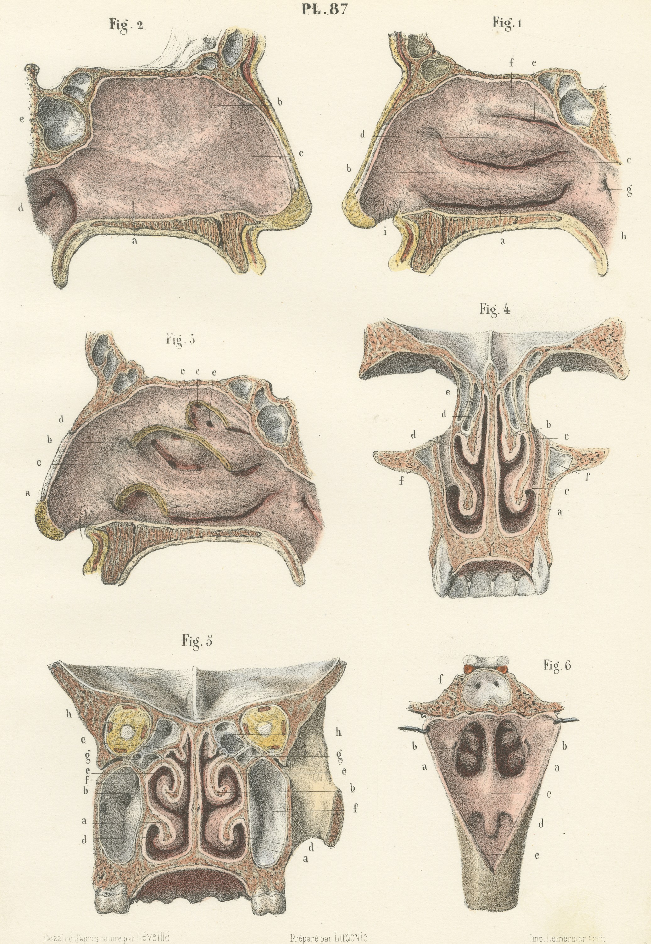 The Lining Membrane of the Nose, Antique Hirschfeld Anatomy Print, 1866