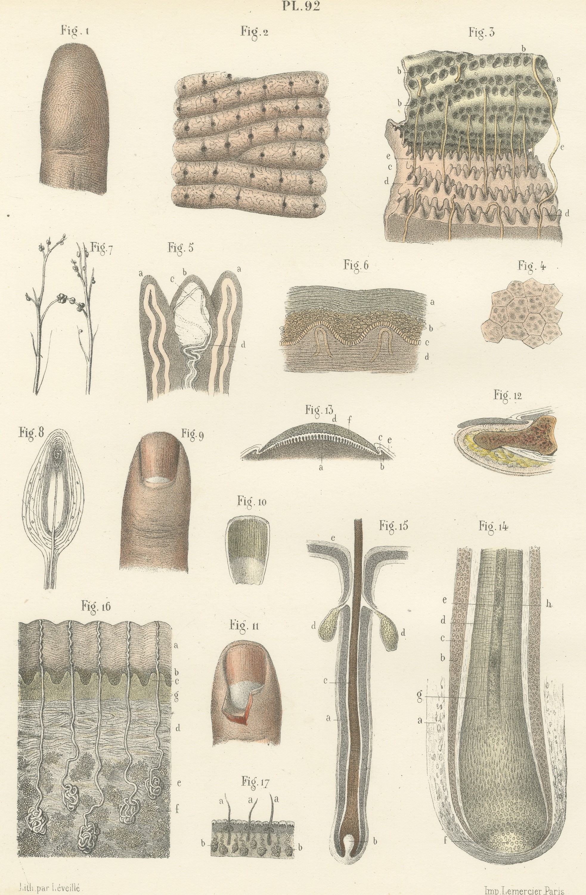 The Skin, Nail and Hair Follicle, Antique Hirschfeld Anatomy Print, 1866