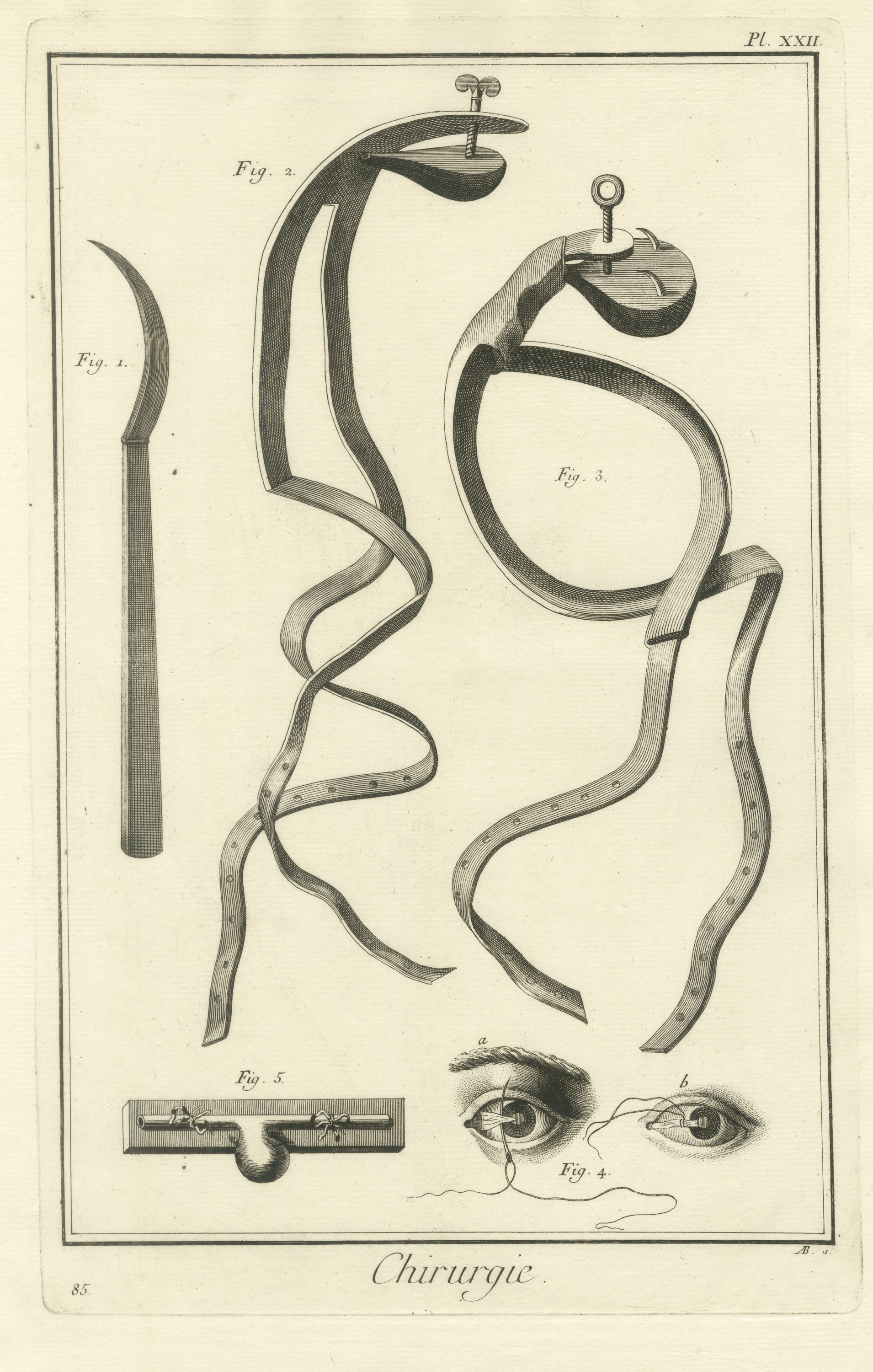 Screw Tourniquets and Eye Studies, Diderot Chirurgie Plate XXII, circa 1772