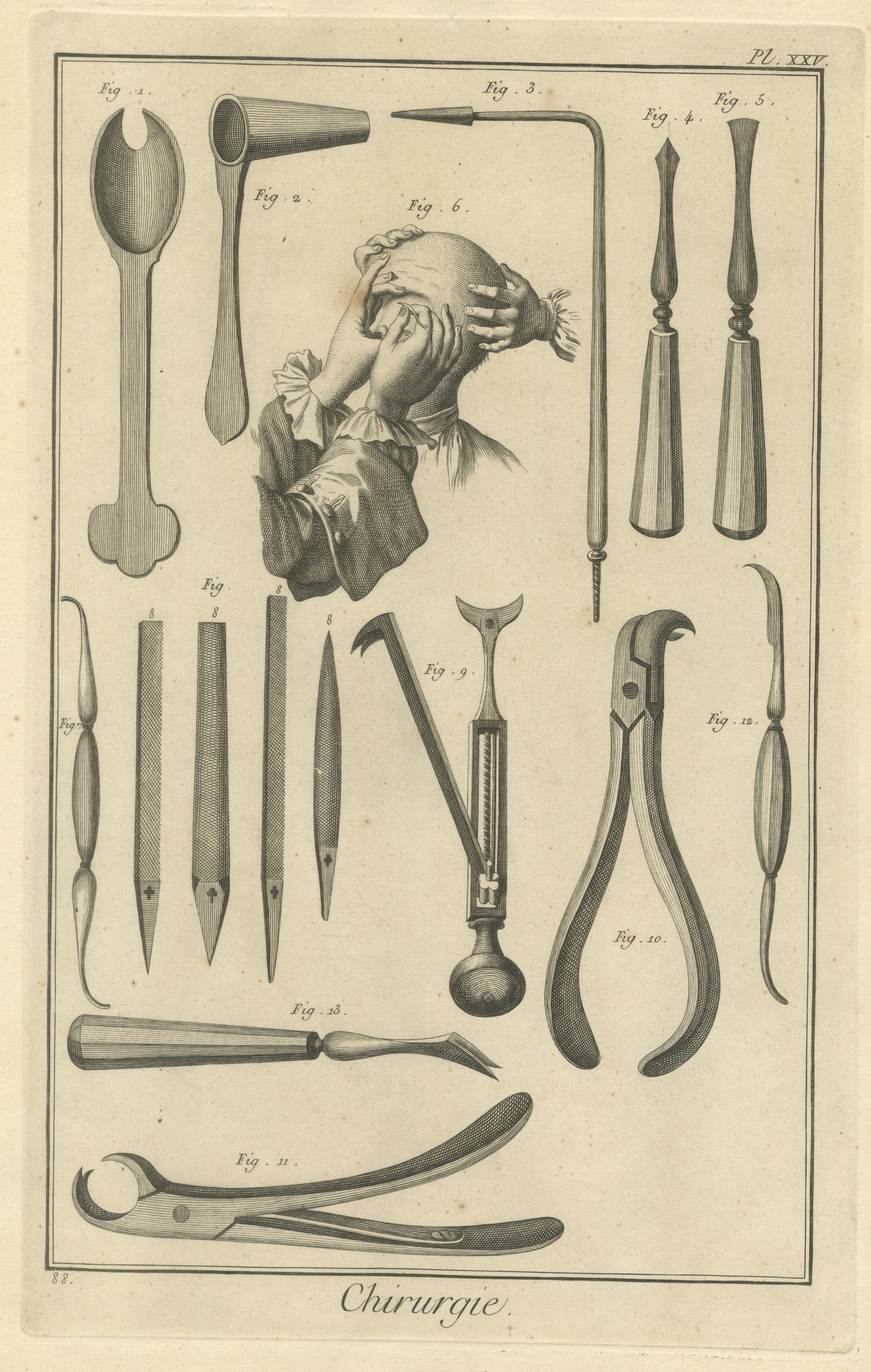 Hooked Forceps, Files and Levers, Diderot Chirurgie Plate XXV, circa 1772