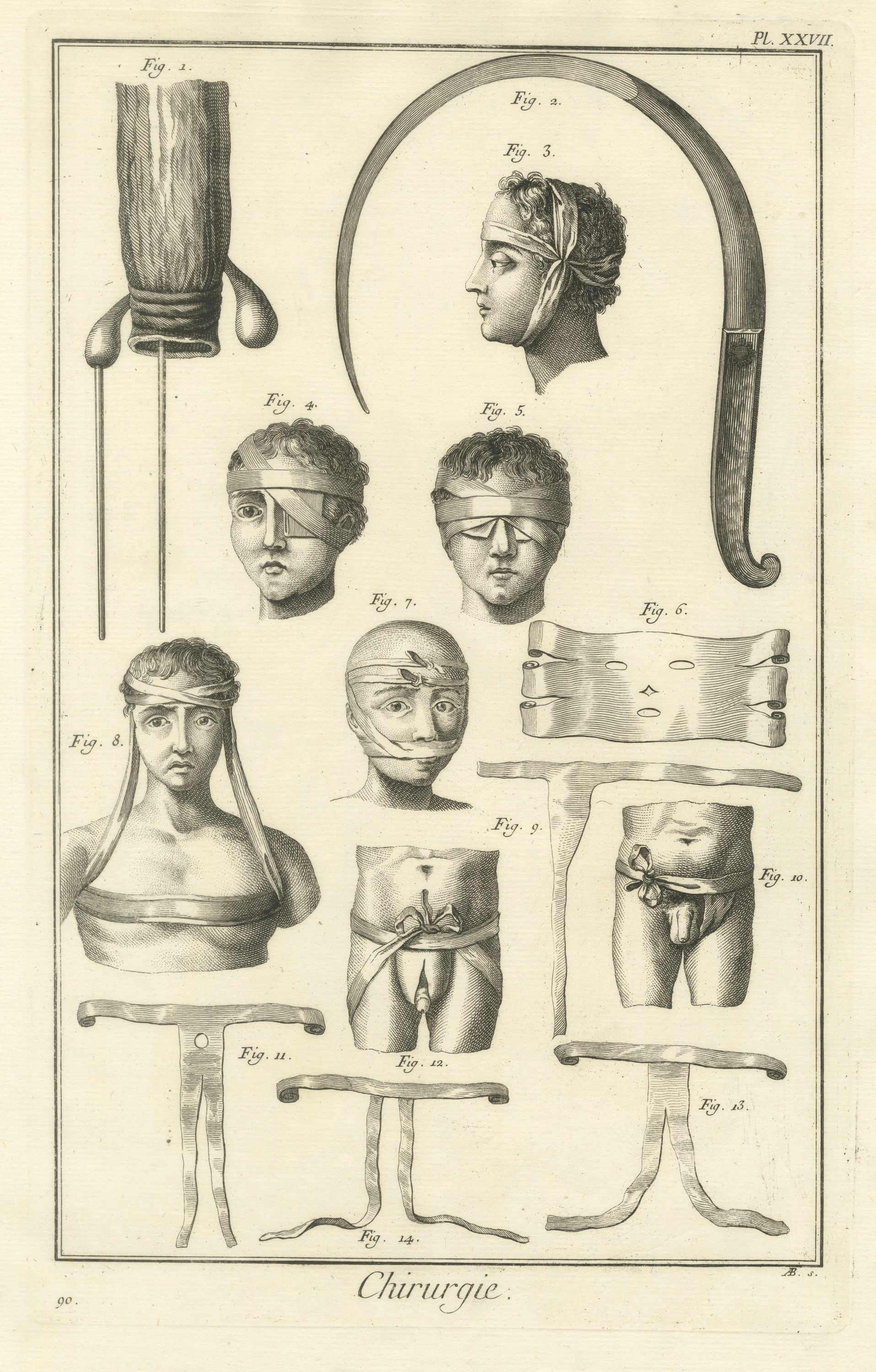 Head, Face and Body Bandages, Diderot Chirurgie Plate XXVII, circa 1772