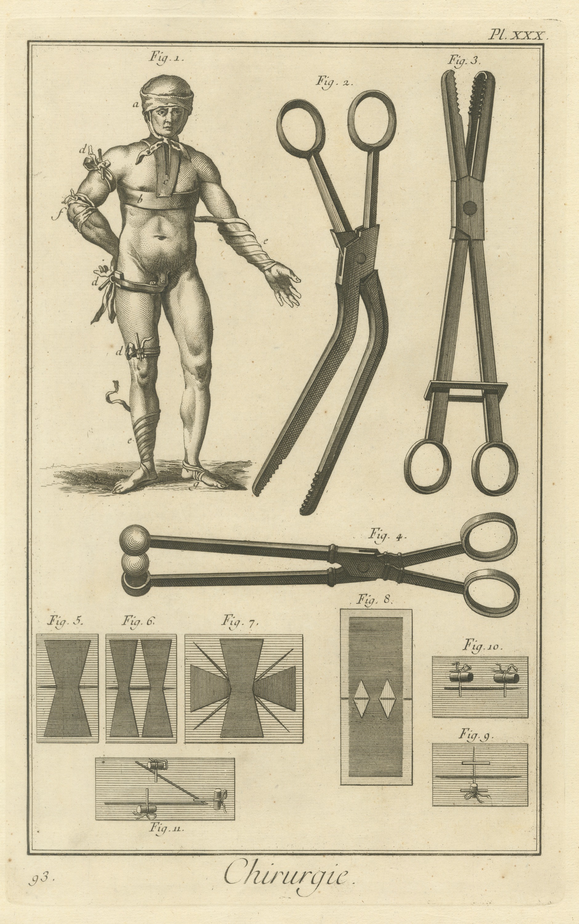 Bandaged Figure, Forceps and Plasters, Diderot Chirurgie Plate XXX, circa 1772