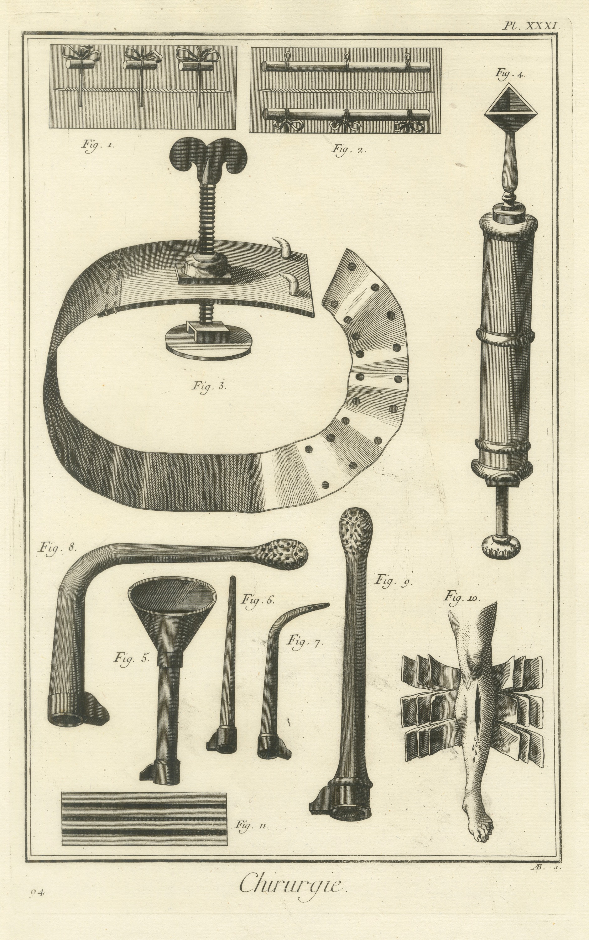 Screw Tourniquet, Syringe and Pipes, Diderot Chirurgie Plate XXXI, circa 1772