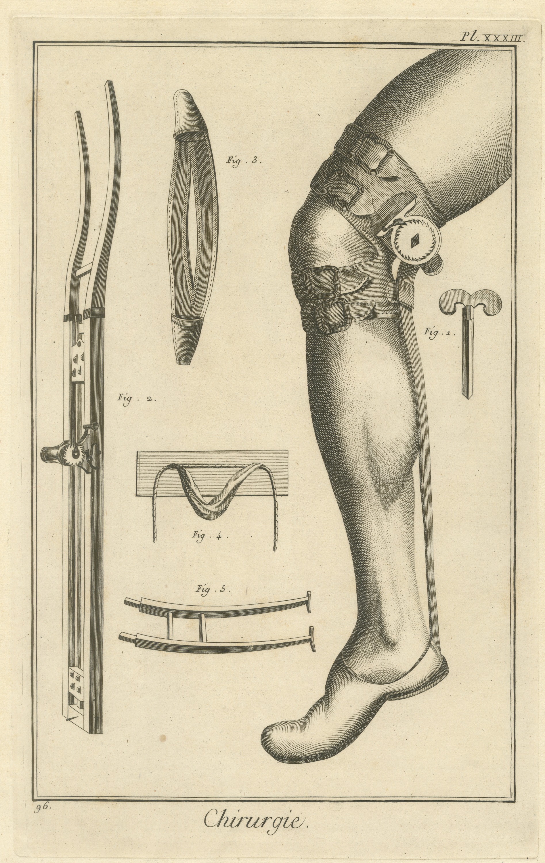 Ratcheted Leg Brace and Splint, Diderot Chirurgie Plate XXXIII, circa 1772