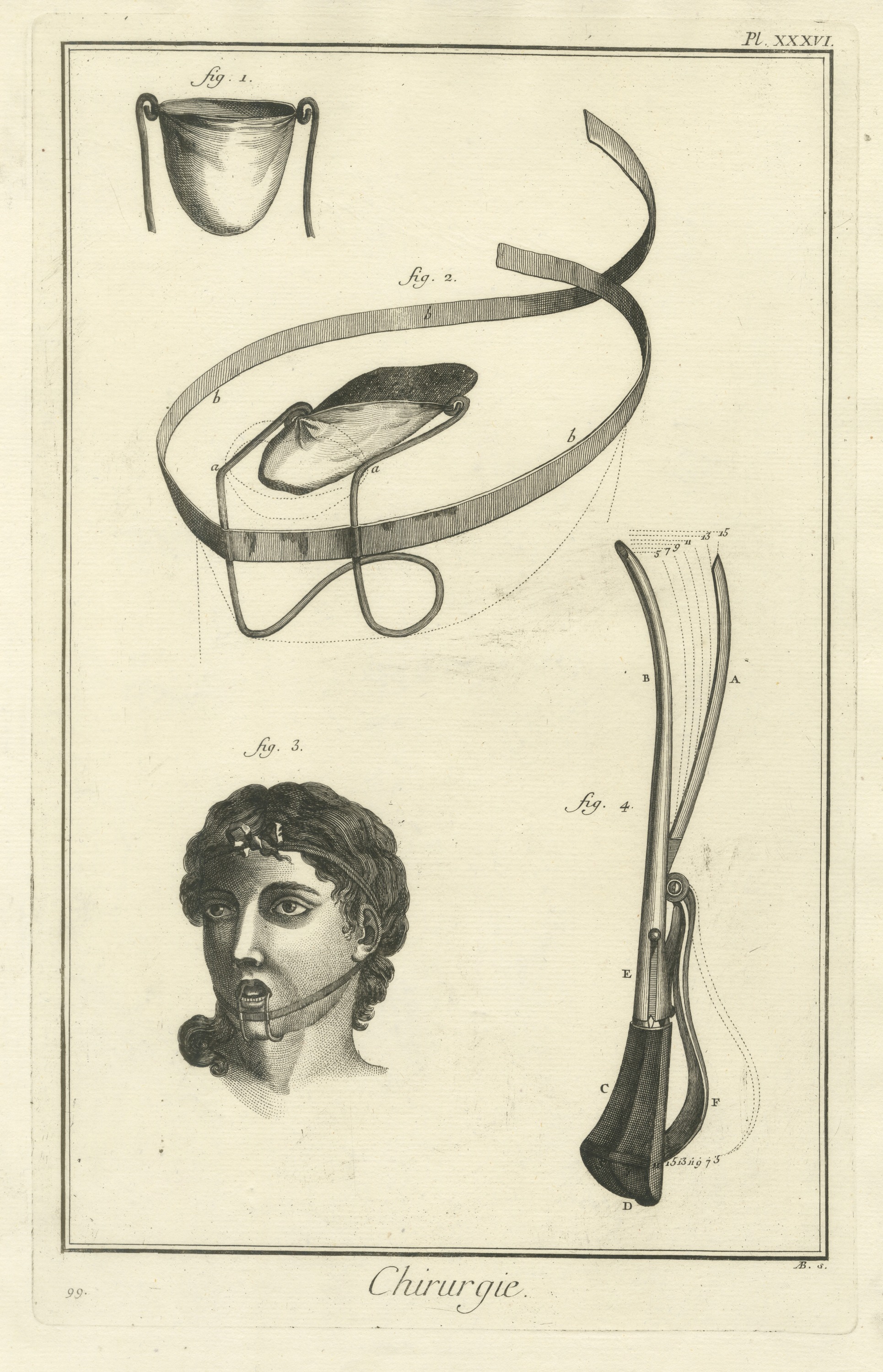 Pouch Belt and Mouth Bit, Diderot Chirurgie Plate XXXVI, circa 1772