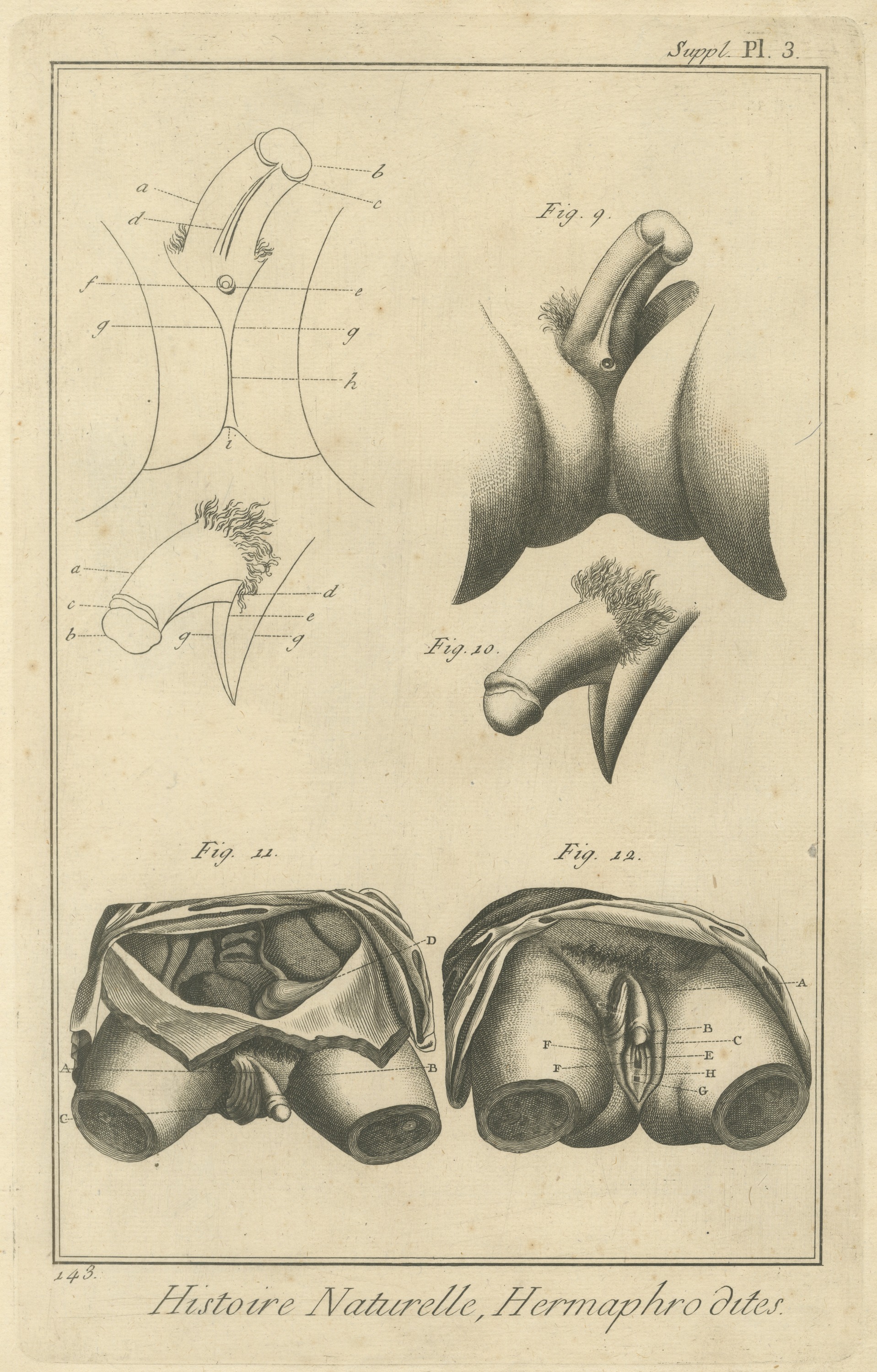 Pelvic Anatomy Studies, Diderot Hermaphrodites Supplement Plate 3, circa 1778