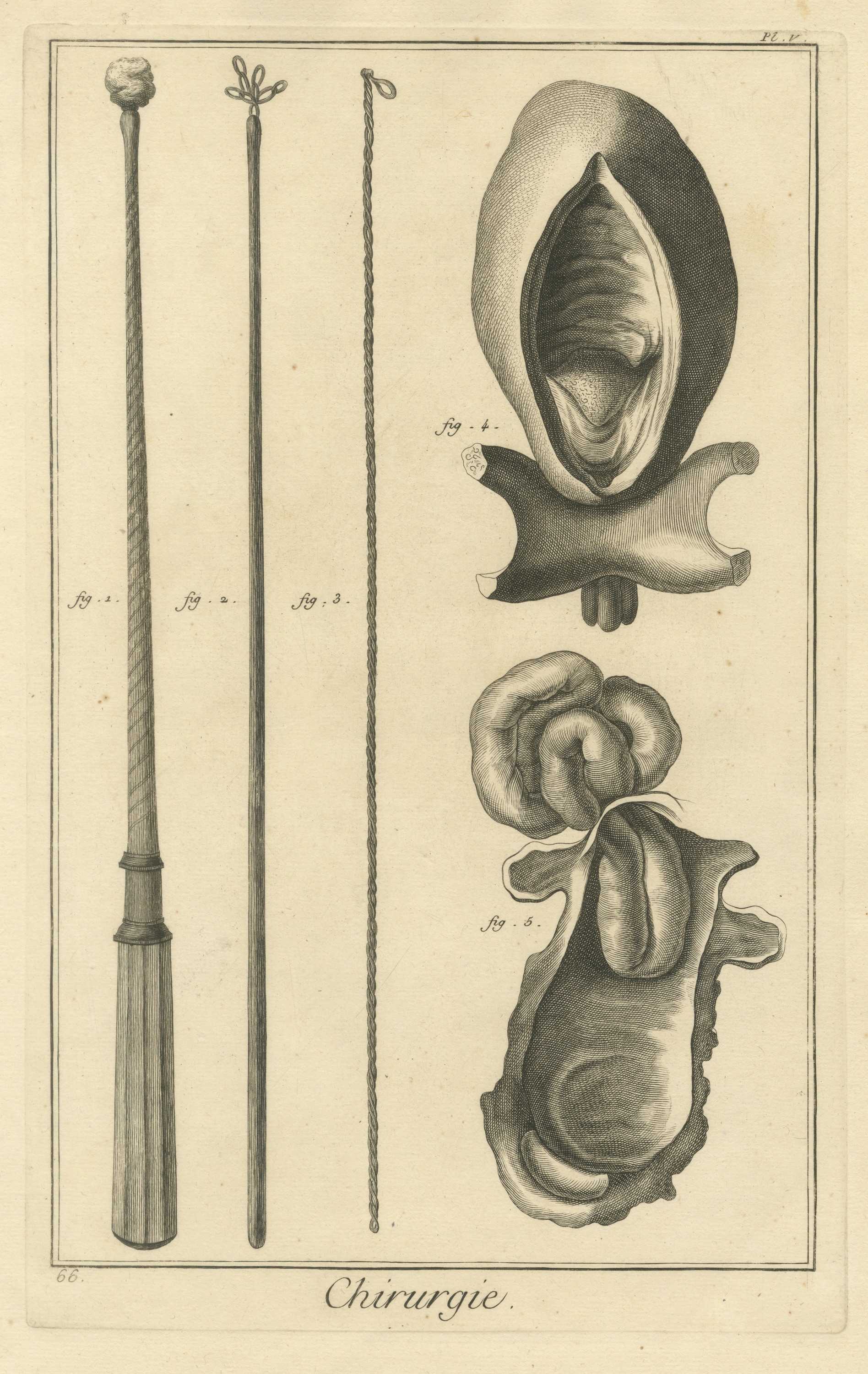 Long Probes and Anatomical Specimens, Diderot Chirurgie Plate V, circa 1772