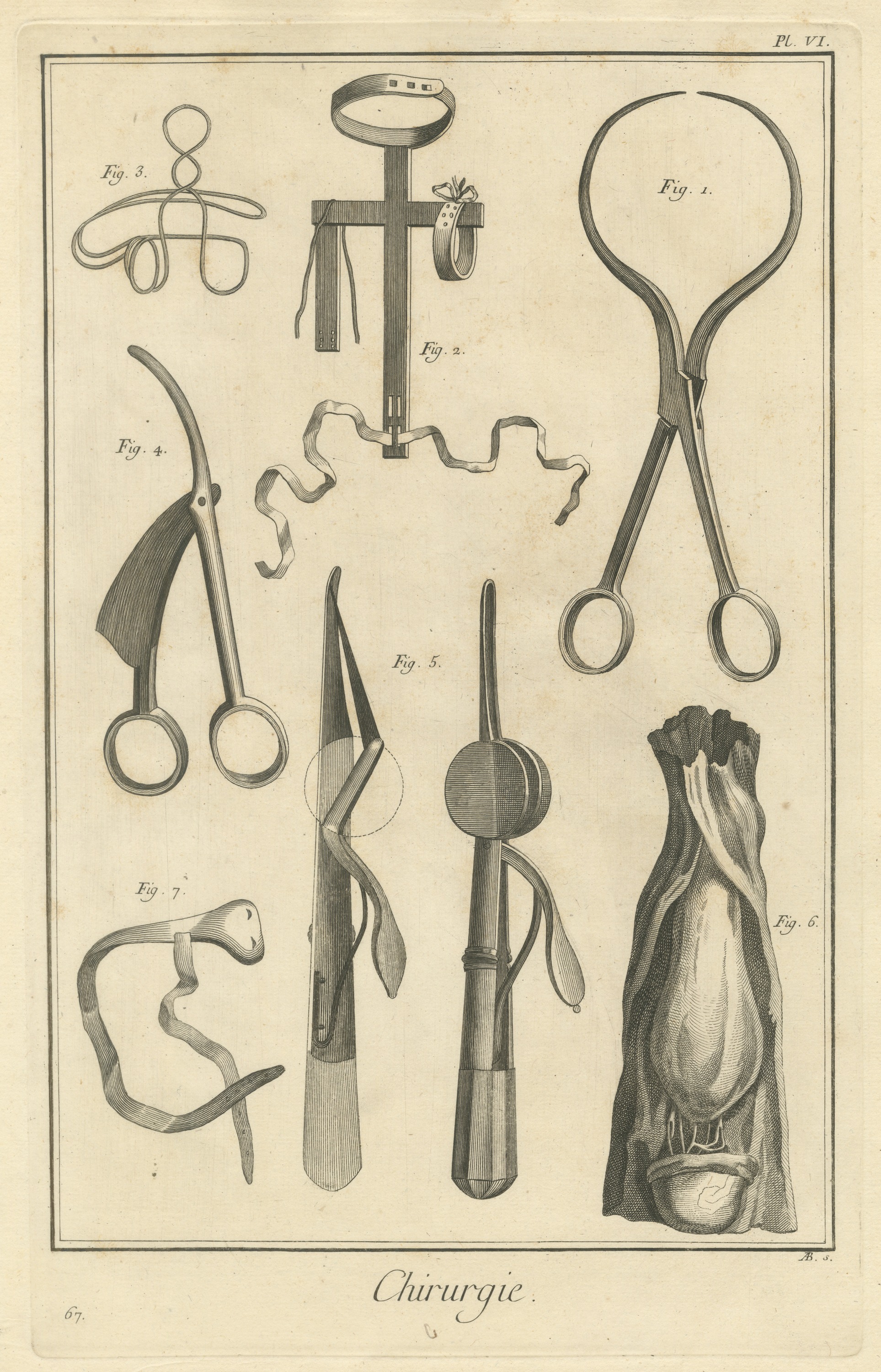 Loop Forceps, Cross Frame and Dissection, Diderot Chirurgie Plate VI, circa 1772